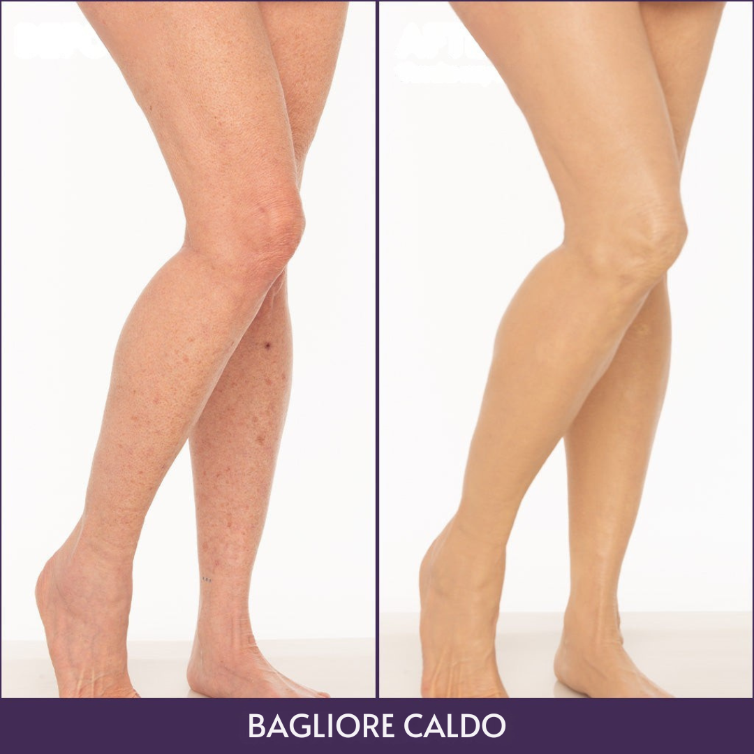 Veloris Perfettore Corpo™ – Fondotinta per una pelle uniforme