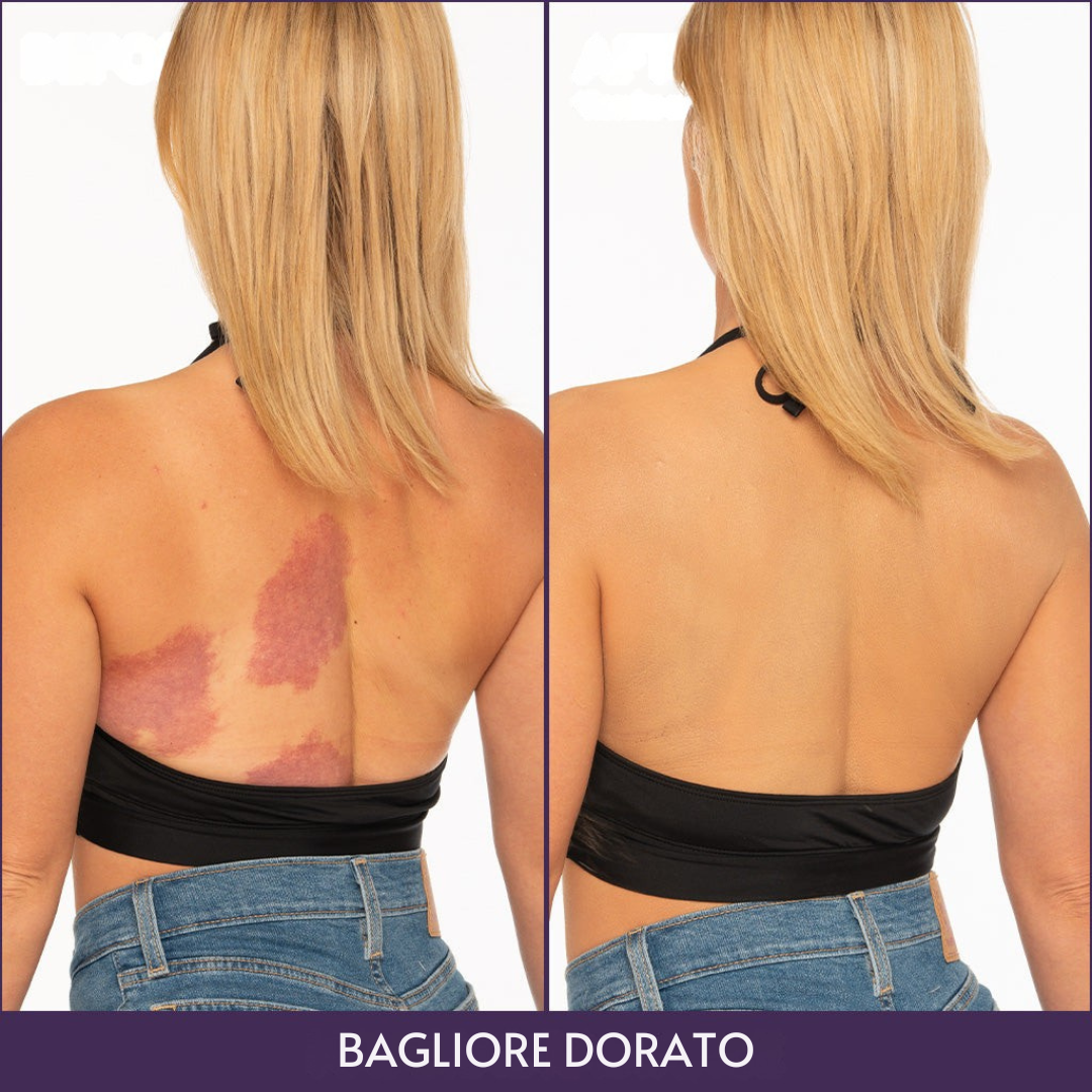 Veloris Perfettore Corpo™ – Fondotinta per una pelle uniforme